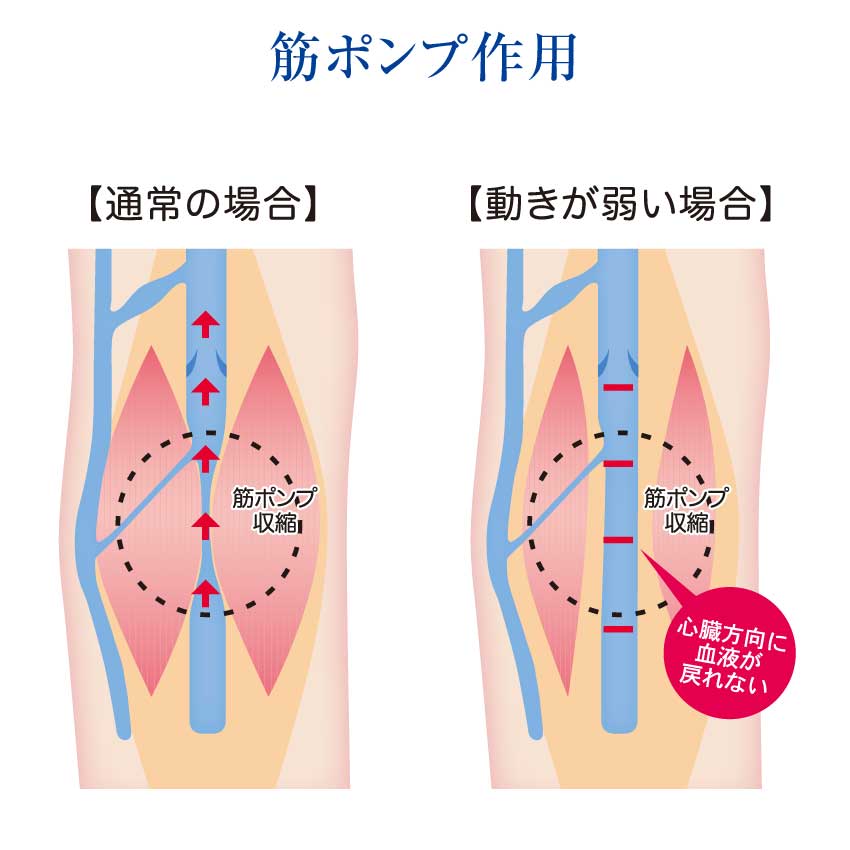 東光 防災用弾性ストッキング ハイソックス